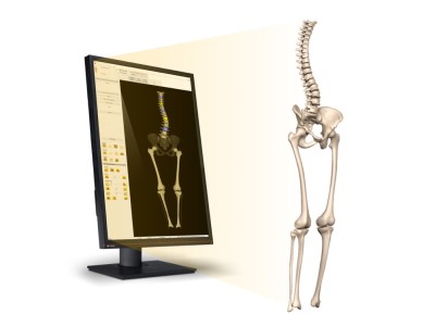 EOS 3D Modeling – EOS IMAGING